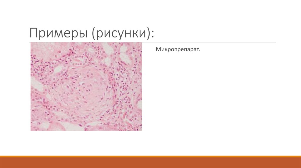 Примеры (рисунки):