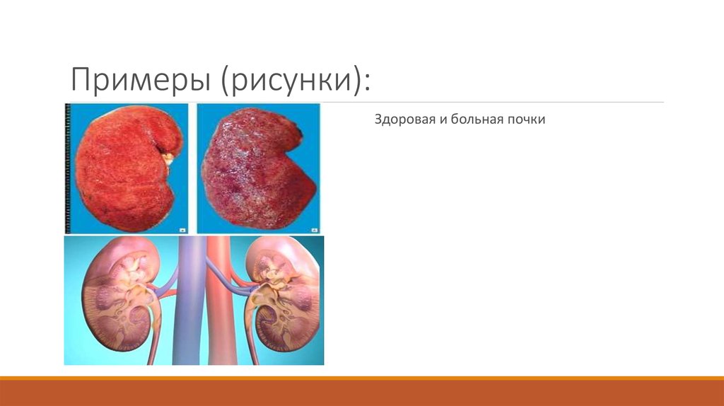 Примеры (рисунки):