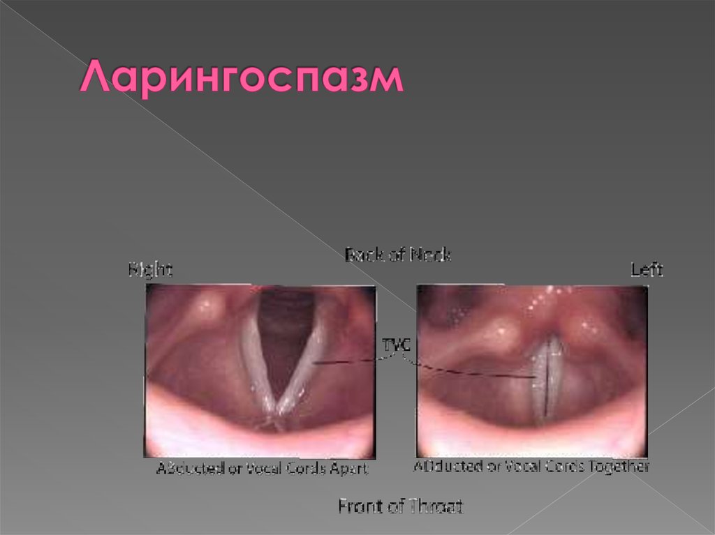 Диета детей с гипервитаминоза д