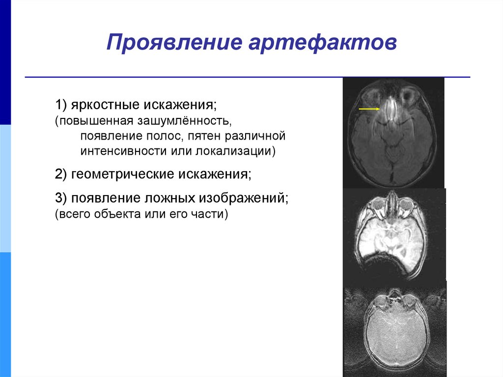 Артефакты в проекте это