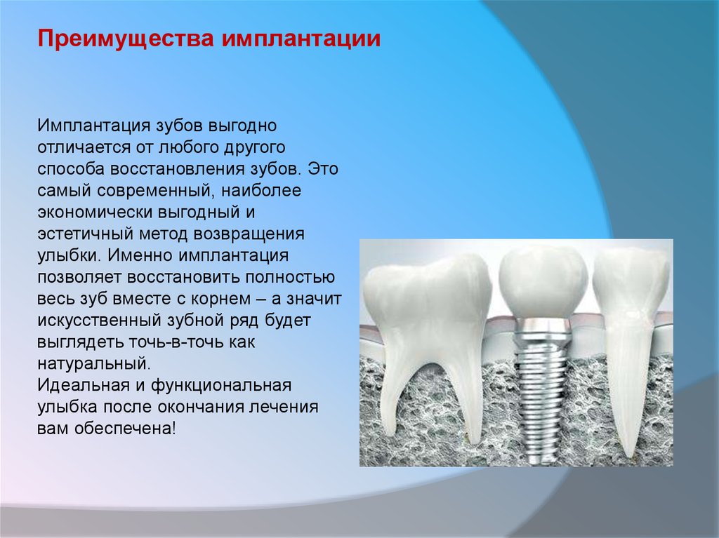 Дентальная имплантация презентация