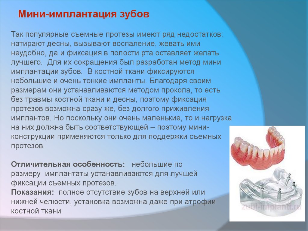 Анатомические предпосылки стоматологической имплантации презентация