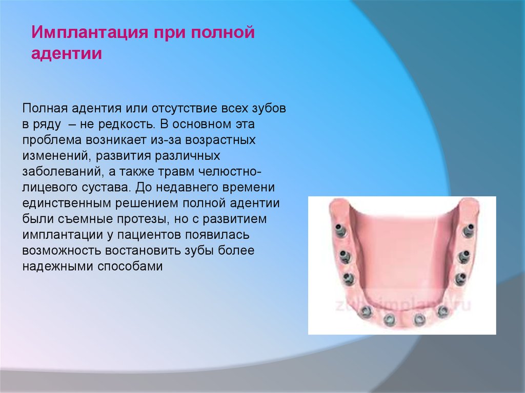 Анатомические предпосылки стоматологической имплантации презентация