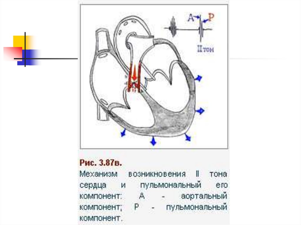 Аускультация сердца схема