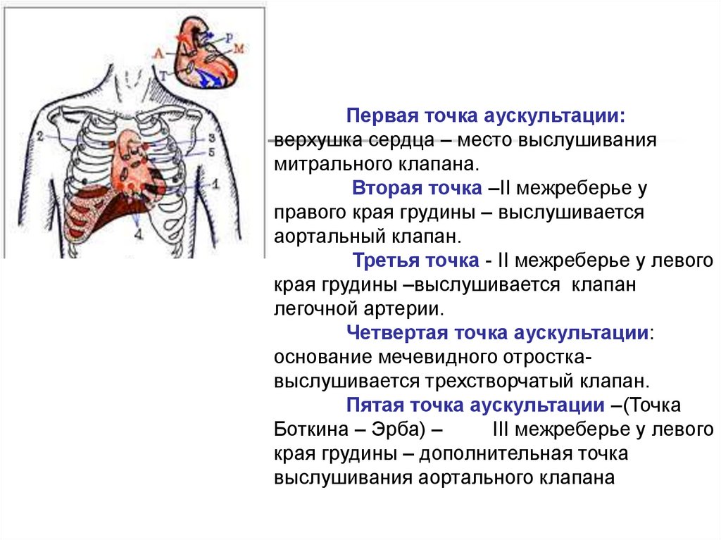 Трахеит аускультативная картина