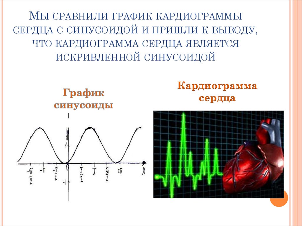 Пульс сердца диаграмма