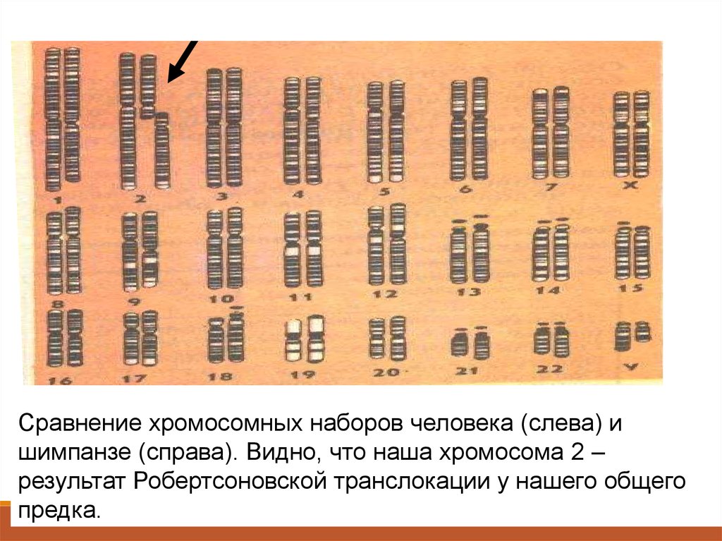 Хромосомный набор человека. Хромосомы человека и шимпанзе сравнение. Сравнение хромосомных наборов человека и шимпанзе. Набор хромосом человека и шимпанзе. Кариотип человека и шимпанзе.