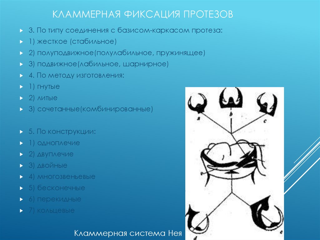 Классификация нея. Точечная кламмерная фиксация. Виды кламмерной системы фиксации. Вид соединения кламмеров с протезом.. Методы фиксации кламмеров.