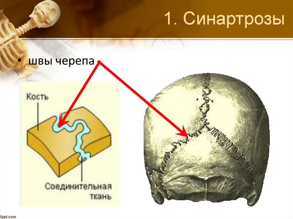 Шов между теменными костями. Соединение костей черепа. Соединение костей черепа анатомия.