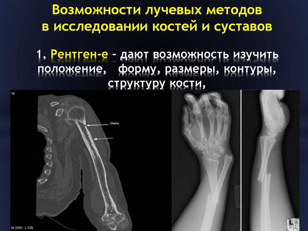 Лучевая диагностика костей презентация