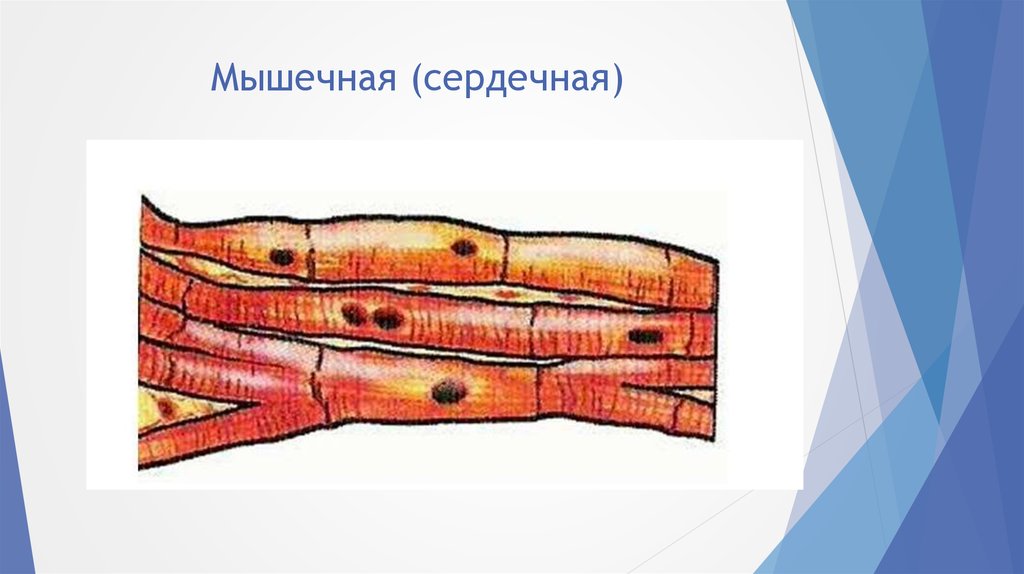 Сердечная мышечная. Сердечная мышца человека. Сердечная мышца человека ткань. Мышечная ткань сердца рисунок.