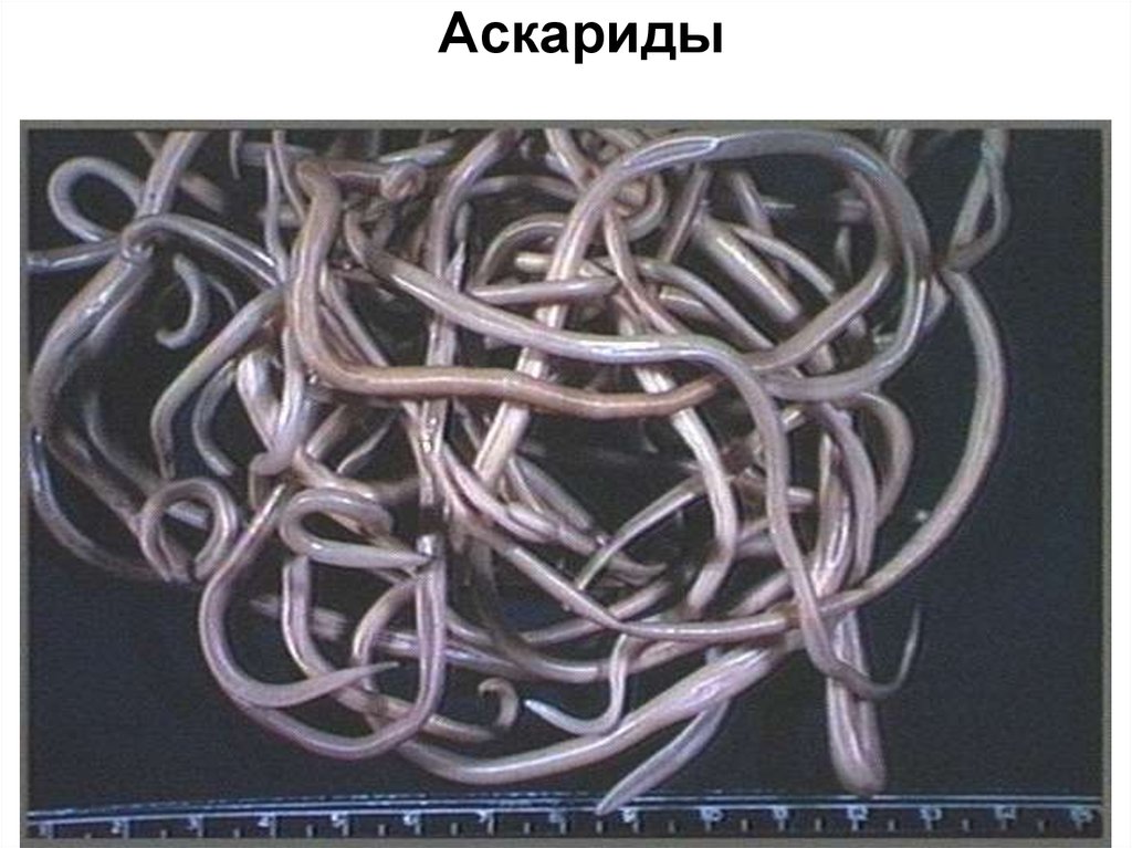 Аскариды лошади. Аскарида человеческая возбудитель аскаридоза. Аскаридоз клубок аскарид.