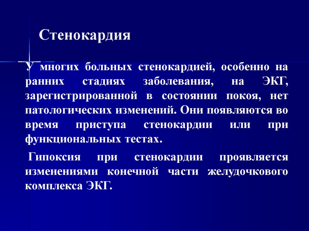 Стенокардия