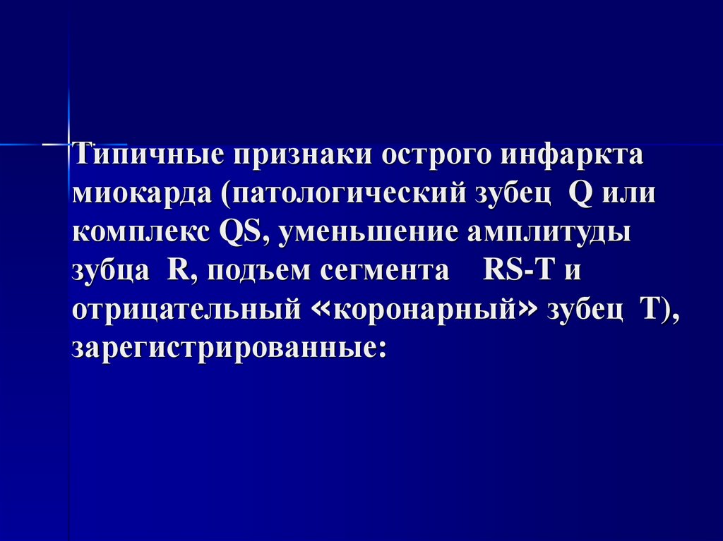 Типичные признаки острого инфаркта миокарда (патологический зубец Q или комплекс QS, уменьшение амплитуды зубца R, подъем