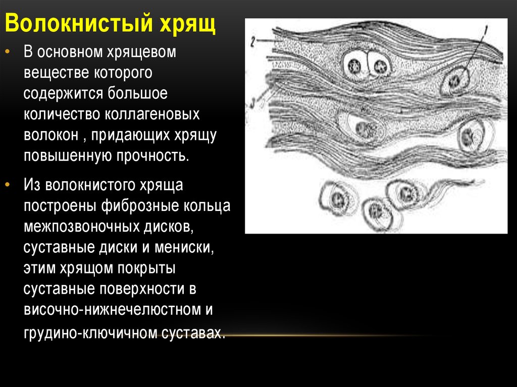 Волокнистый хрящ рисунок