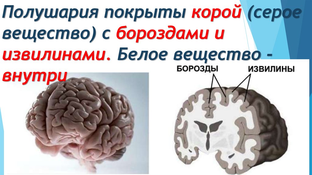 Функции серого вещества головного мозга. Серое вещество полушарий мозга. Серое и белое вещество больших полушарий.