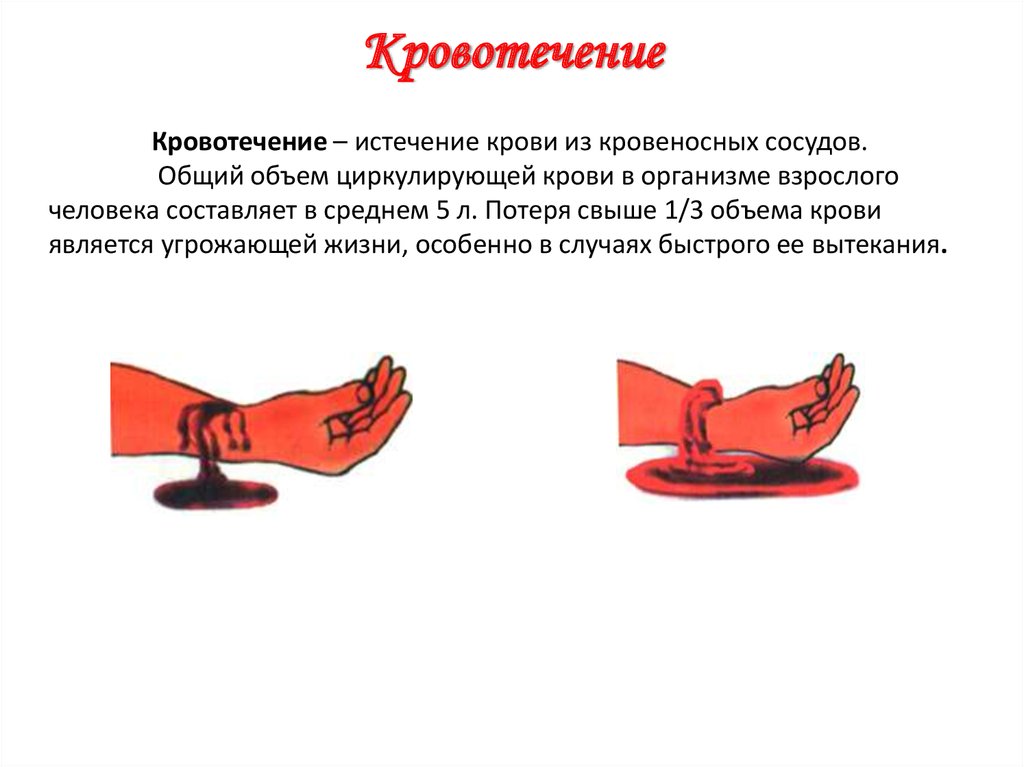 Первая помощь при наружном и внутреннем кровотечении урок обж 8 класс презентация