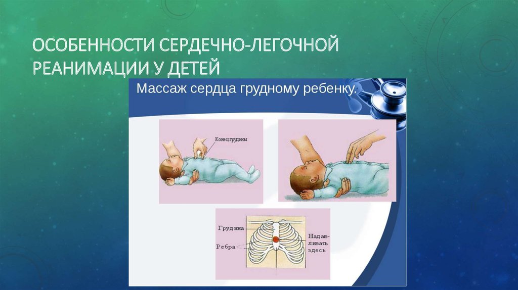 Слр у детей презентация