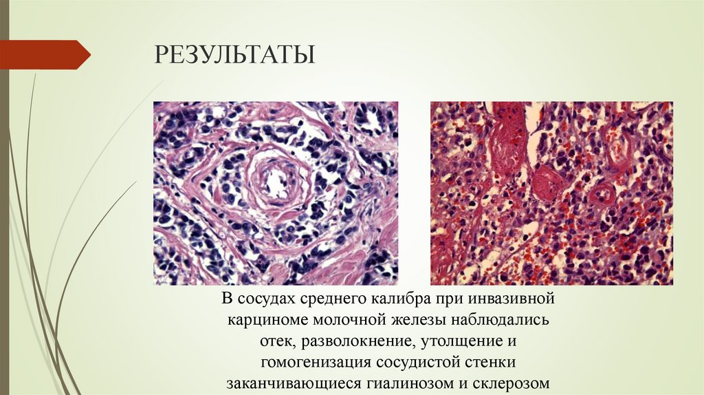 РЕЗУЛЬТАТЫ