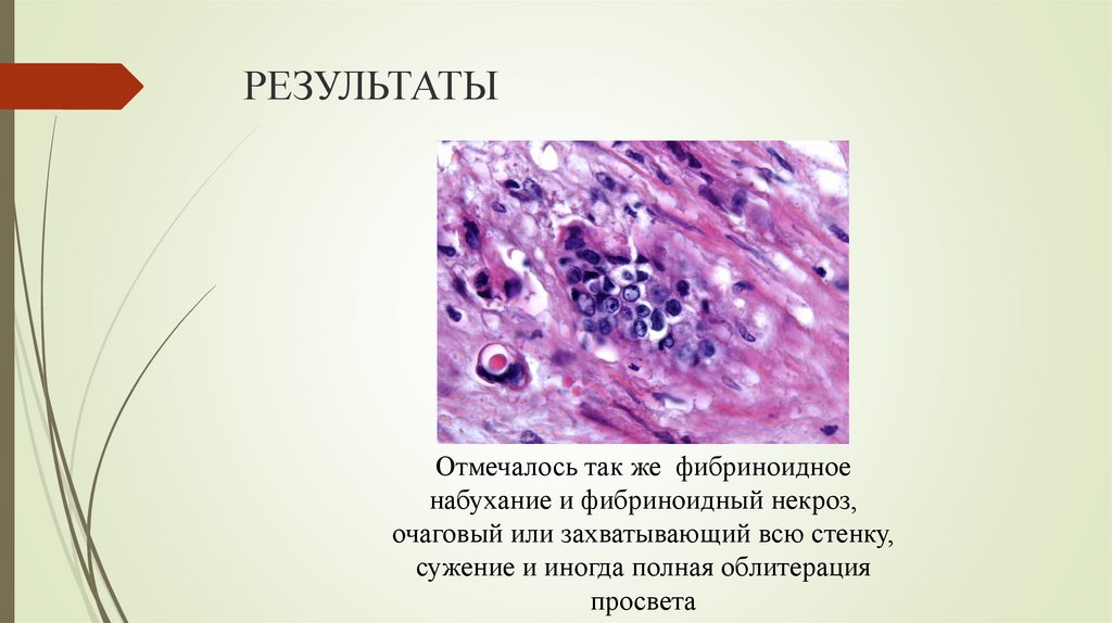 РЕЗУЛЬТАТЫ