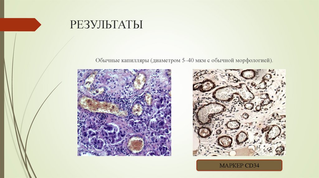 РЕЗУЛЬТАТЫ