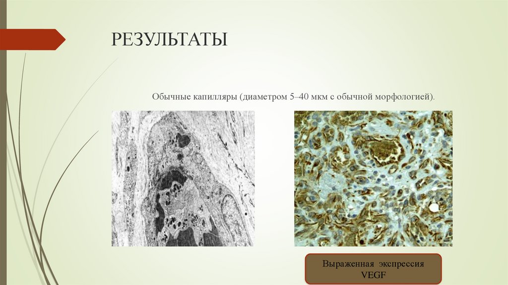 РЕЗУЛЬТАТЫ