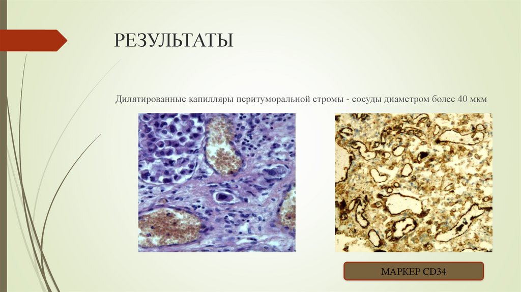 РЕЗУЛЬТАТЫ