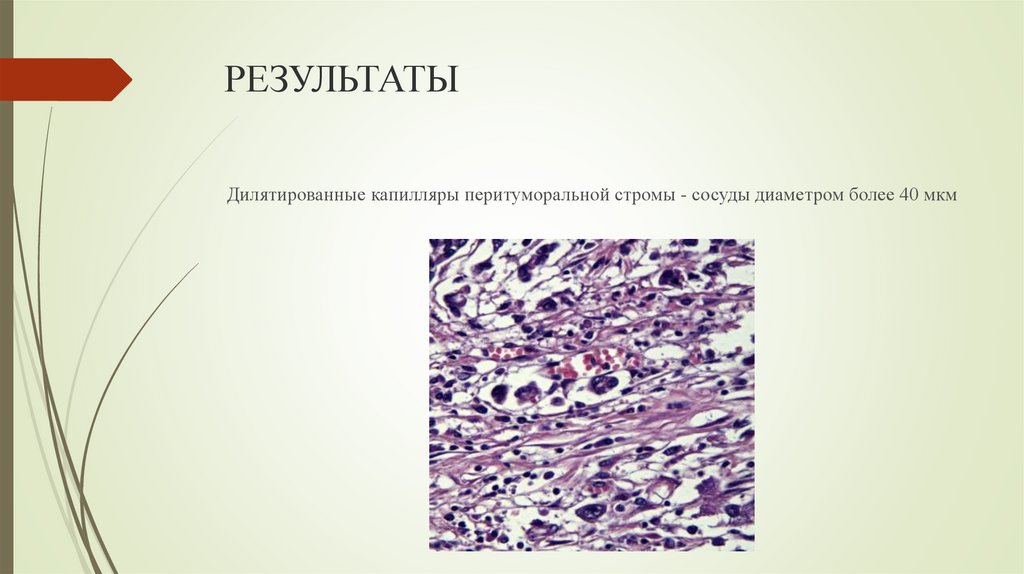 РЕЗУЛЬТАТЫ