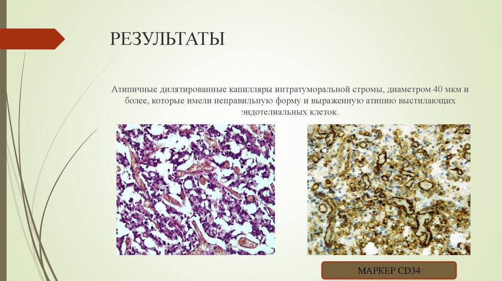 РЕЗУЛЬТАТЫ