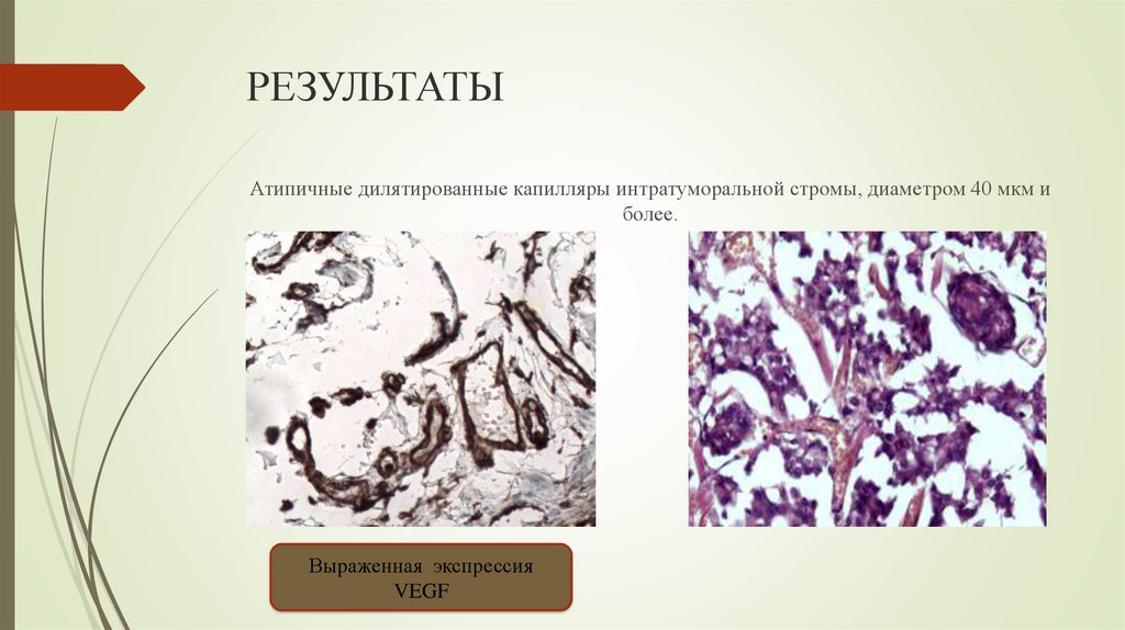 РЕЗУЛЬТАТЫ