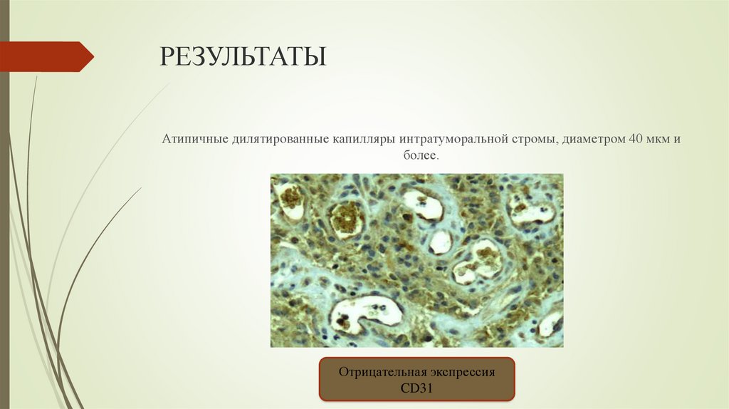 РЕЗУЛЬТАТЫ