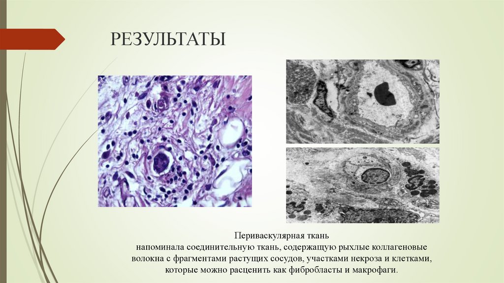 РЕЗУЛЬТАТЫ