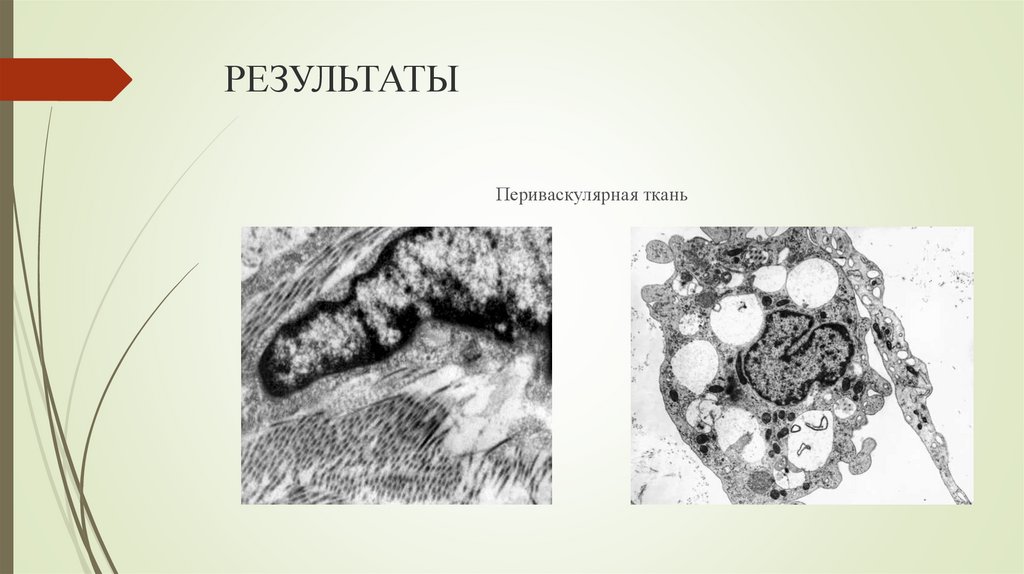 РЕЗУЛЬТАТЫ