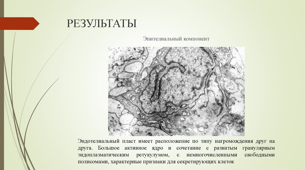 РЕЗУЛЬТАТЫ