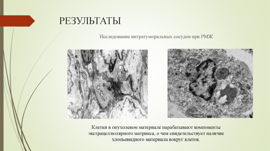 РЕЗУЛЬТАТЫ