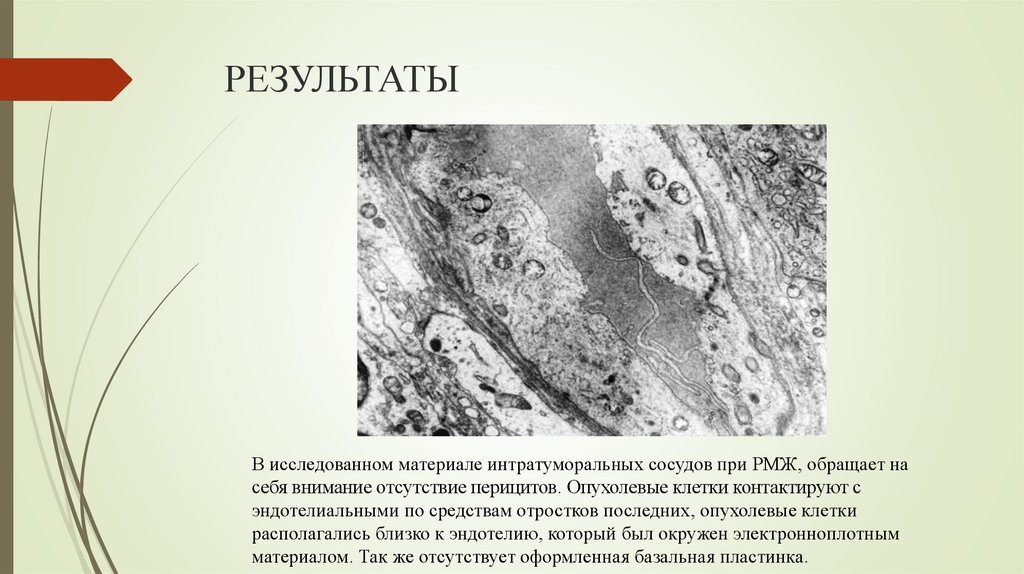 РЕЗУЛЬТАТЫ