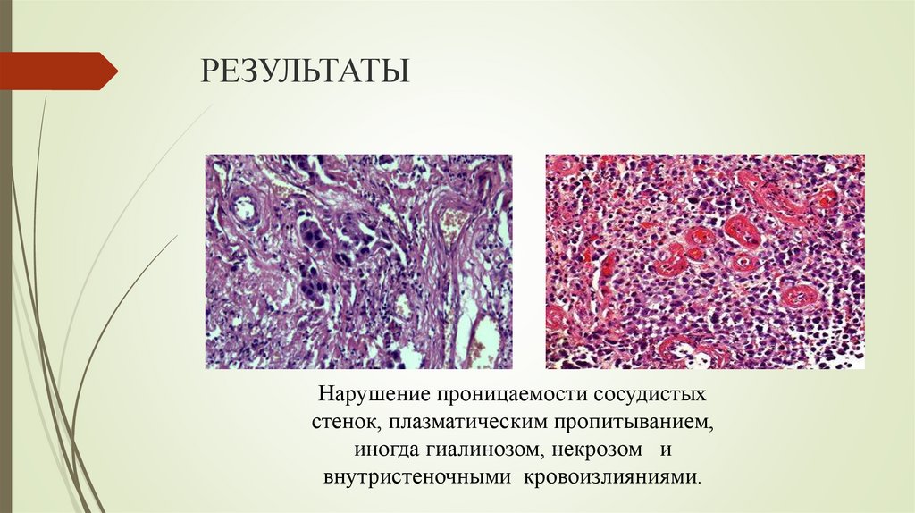 РЕЗУЛЬТАТЫ