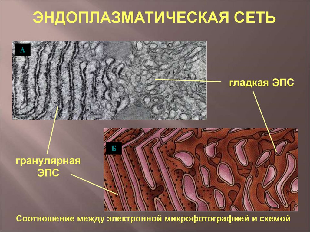 Гранулярная эпс. Эндоплазматическая сеть гладкая ЭПС. Гладкая ЭПС микрофотография. Электронная микрофотография - гладкая эндоплазматическая сеть.. Гранулярная и гладкая ЭПС.