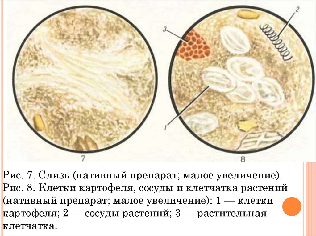 Копрограмма обнаружены грибы. Копрология кала микроскопия. Атлас копрограмма микроскопия. Микроскопия кала атлас копрология. Мышечные волокна в Кале микроскопия.