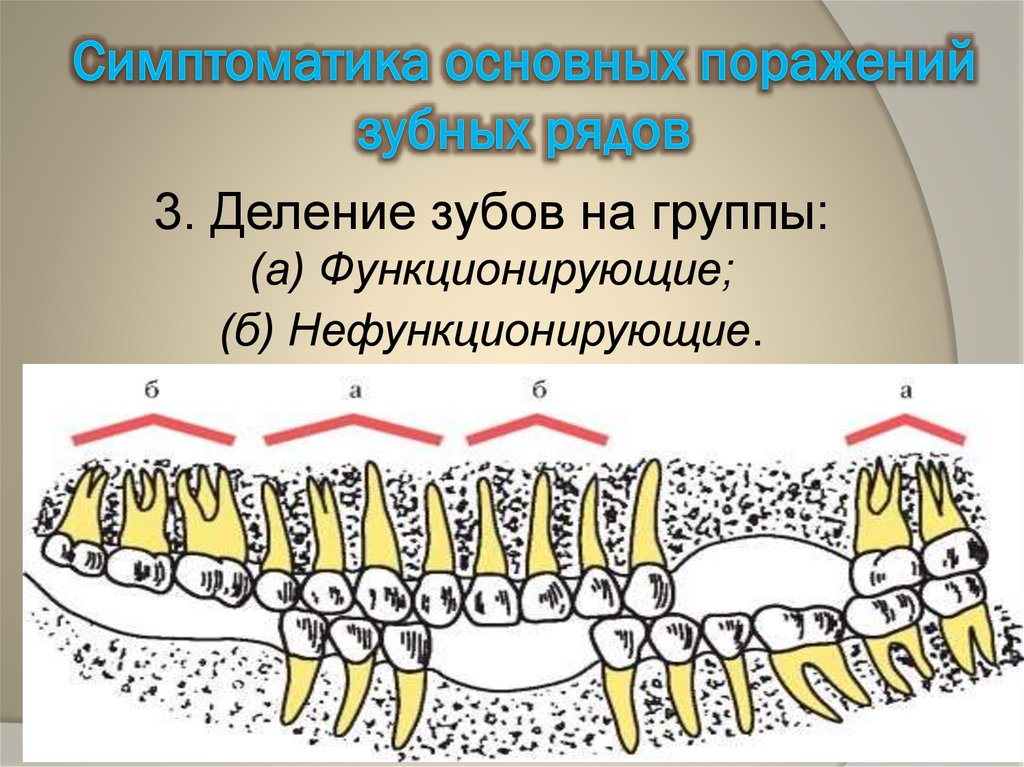 Зуб рядом. Деление зубов на группы. Функционирующая и нефункционирующая группа зубов.