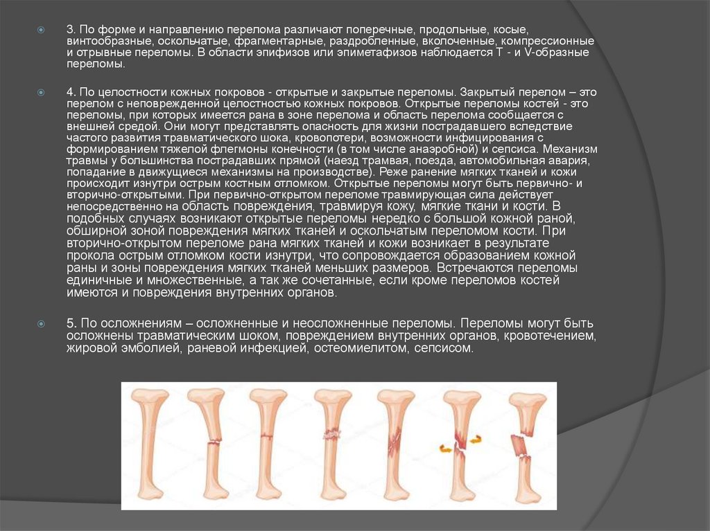 Закрытые переломы презентация