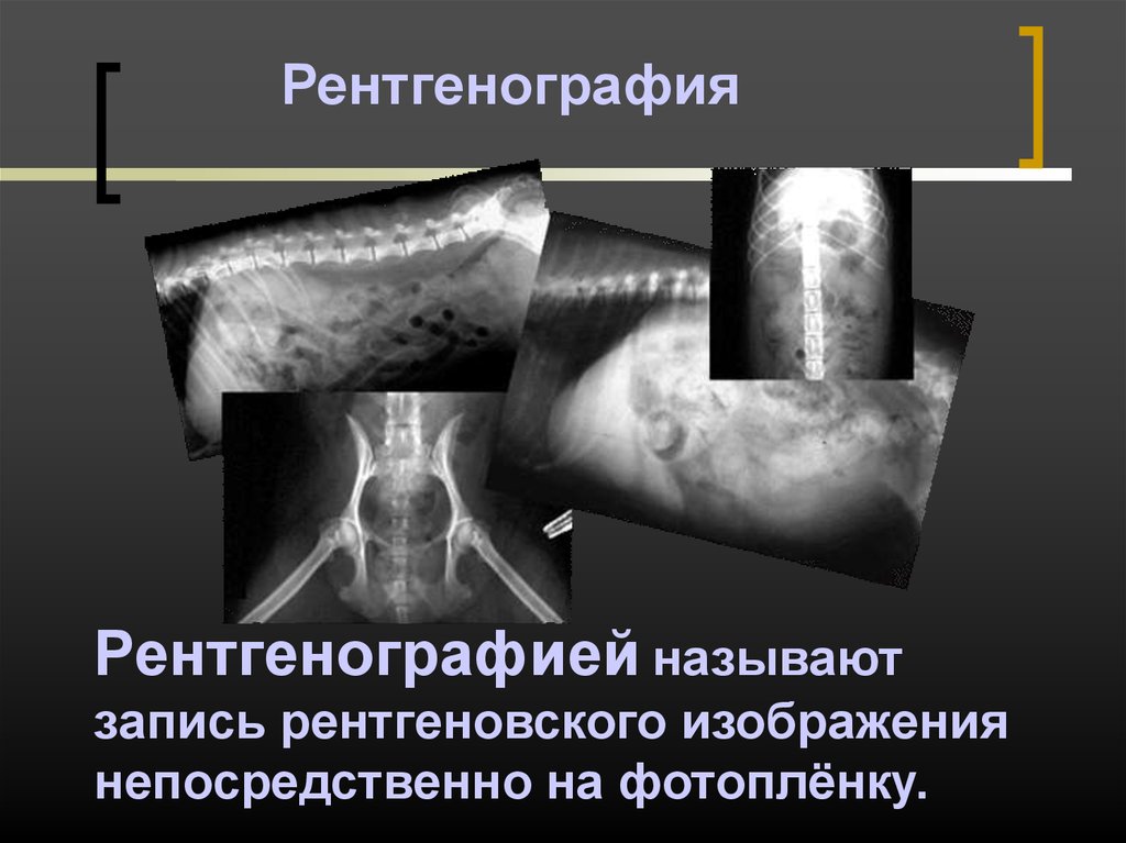 Рентгенография. Рентгеноскопия и рентгенография. Рентгеноскопия и рентгенография разница. Разница рентгенограмма и рентгеноскопии. Рентгенография от рентгеноскопии.