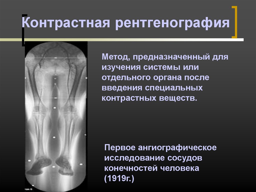 Контрастная чувствительность рентгеновского изображения