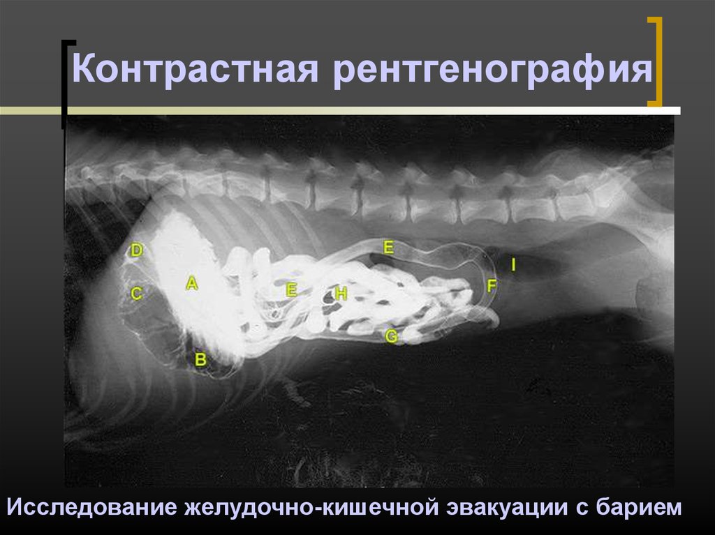 Рентгеноскопия контрастное вещество. Контрастная рентгенография. Контрастная рентгеноскопия (рентгенография). Контрастная ренография это. Контрастнаяренггенография.