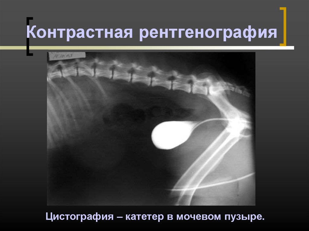 Презентация на тему рентгеноскопия