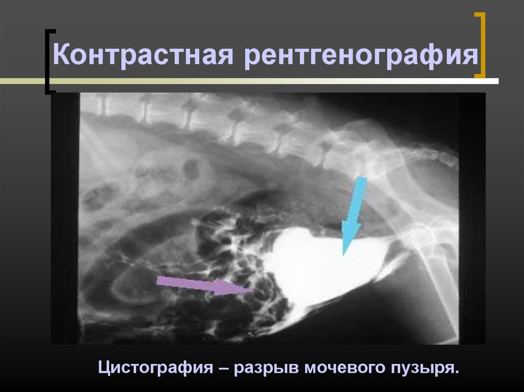 Рентгенография и рентгеноскопия. Контрастная рентгенография. Рентген контрастирование. Контрастная рентгеноскопия (рентгенография). Контрастность рентген.