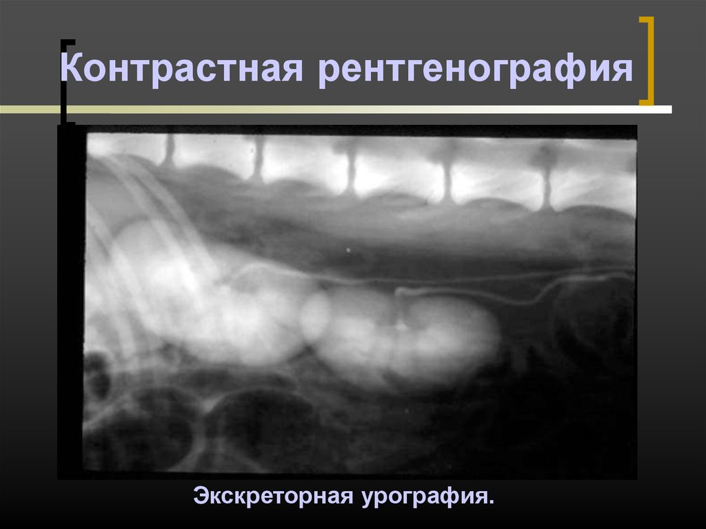 Рентгенография и рентгеноскопия. Контрастная рентгеноскопия. Контрастная рентгеноскопия снимки. Контрастность рентген. Контрастная рентгеноскопия (рентгенография).