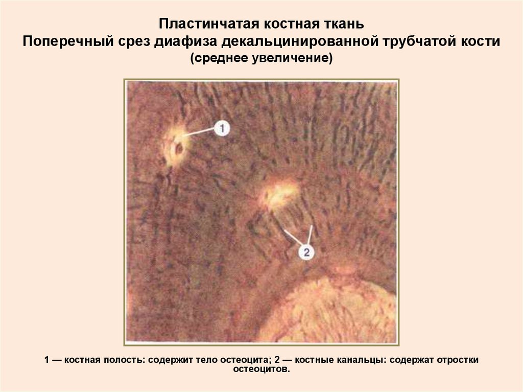 Трубчатая ткань. Пластинчатая компактная костная ткань диафиза. Компактное вещество трубчатой кости гистология. Пластинчатая костная ткань диафиза трубчатой кости поперечный. Пластичная костная ткань гистология.