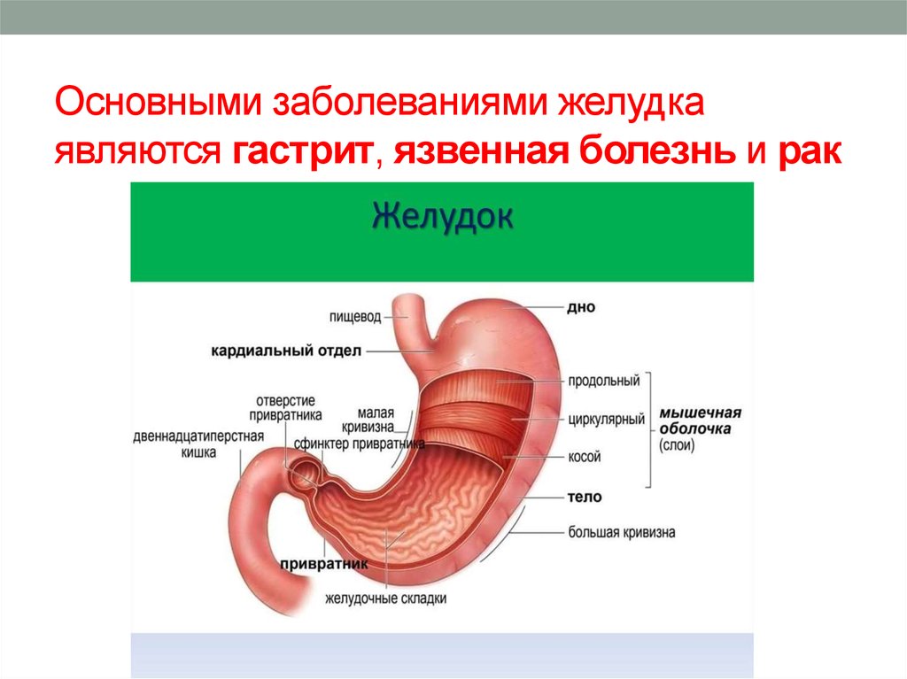 Язвенной болезни желудка презентация