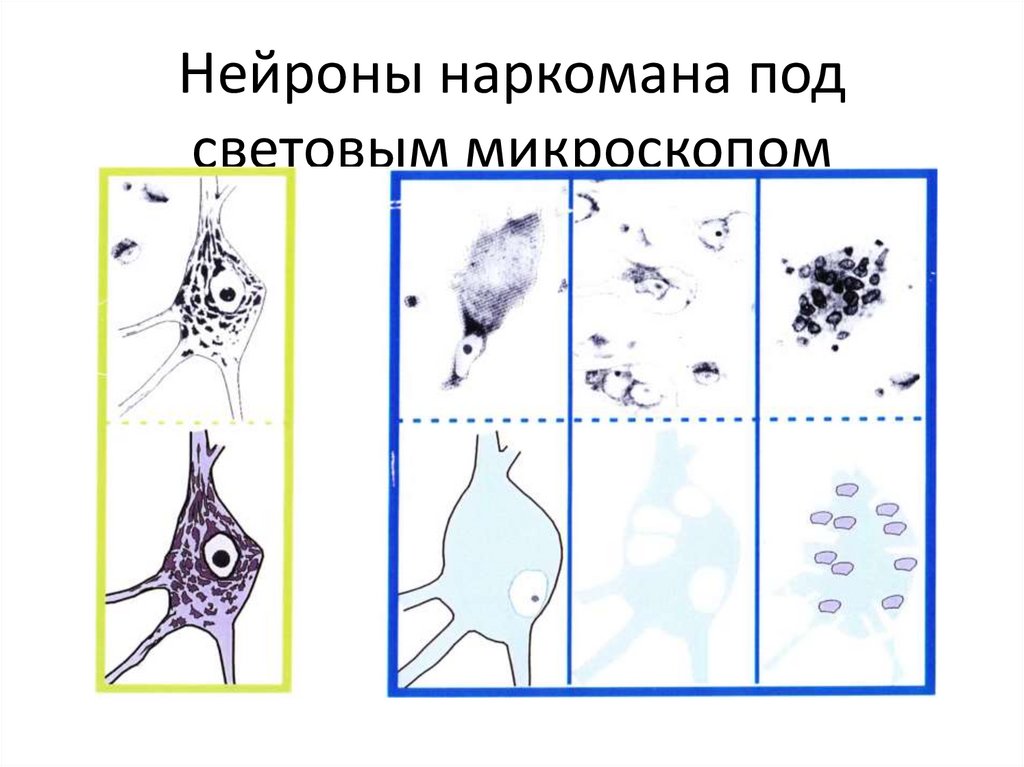 Искусственный нейрон презентация